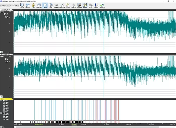 Image Solution Neuromonitoring 09